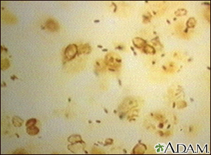 Legionnaire disease organism, legionella