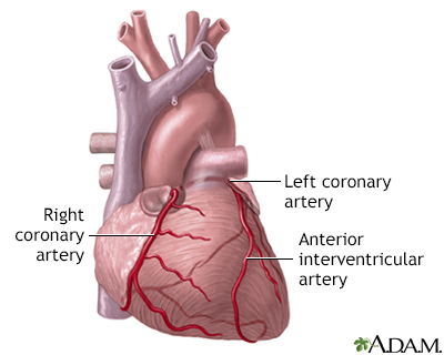 Heart Anterior Wall
