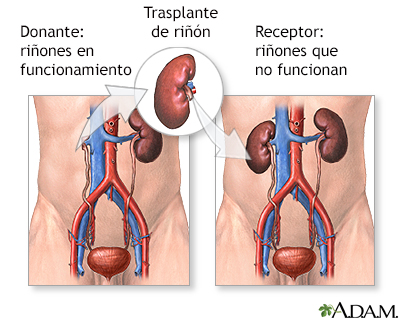 Duele la espalda a la carrera y los saltos